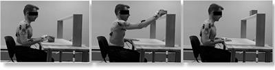 Characterization of Upper Limb Impairments at Body Function, Activity, and Participation in Persons With Multiple Sclerosis by Behavioral and EMG Assessment: A Cross-Sectional Study